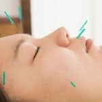 Acupuncture uses needles to puncture the surface of the skin
